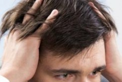 چند علت مهم برای ریزش مو