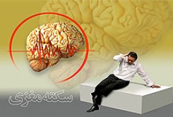 نشانه اصلی سکته مغزی چیست؟