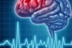دو فاکتور سکته مغزی در بیماران قلبی