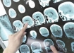 مشاهده فعالیت مغزی تا ۱۰ دقیقه پس از مرگ!