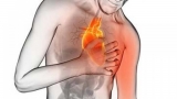 نقش استرس در بروز دردهای قلبی