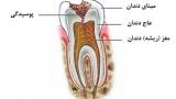 ۶ ترفند محرمانه دندانپزشکان برای جلوگیری از پوسیدگی دندان