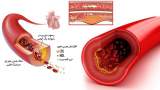 تغذیه پیشنهادی برای درمان چربی خون بالا